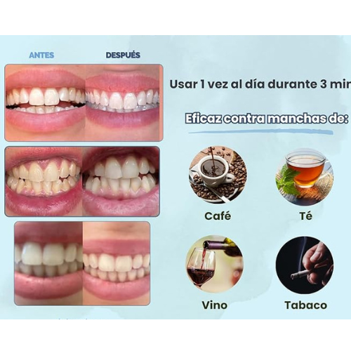 GlowSmile – 50% de descuento en tu kit (resultados en 7 días o reembolso total)